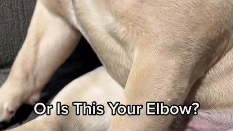 Is This Your Elbow?