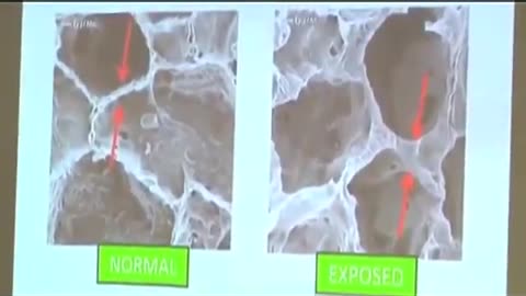 Low Frequency Noise And Health A WT Case - Mariana Alves-Pereira