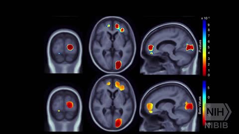 EXERCISE , MIND, AND BRAIN