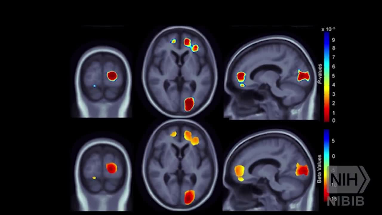 EXERCISE , MIND, AND BRAIN