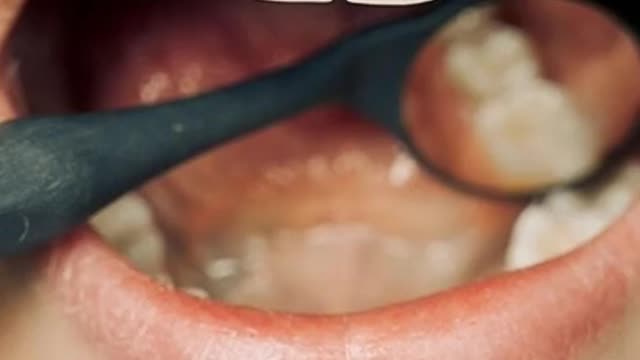 Keep healthy your teeth| Dental health supplement #short