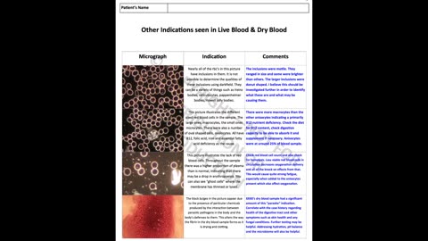 Live Blood Analysis - Coagulation Defects