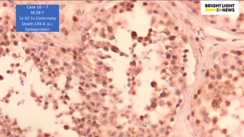 I would not plan Motherhood with a vaccinated man