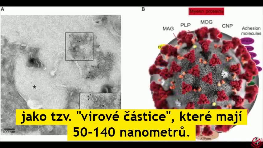 Konec infekční teorie - druhý díl - pavěda jménem virologie