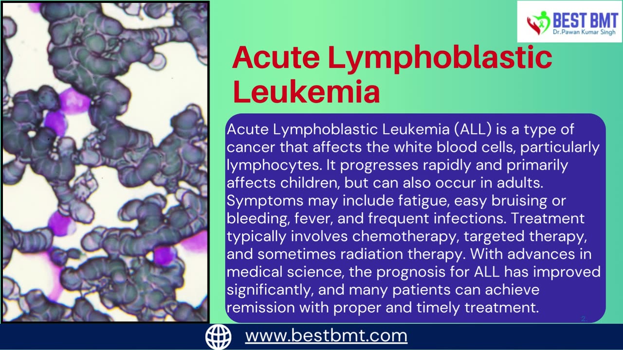 Understanding of Acute Lymphoblastic Leukemia