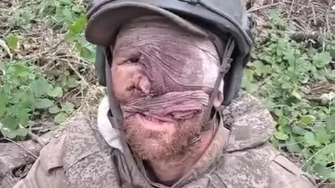 Russian Soldier Surrenders to Ukrainians with Only Half a Face