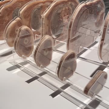 Throwback When I Went to the Exhibition BODIES in Las Vegas! #shorts