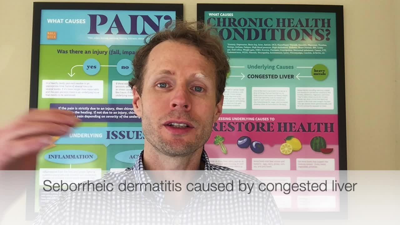 Dermatitis, Seborrheic Dermatitis