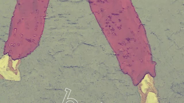 Eriwoya - IGTV Video