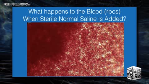 Pfizer Blood under MicroScope