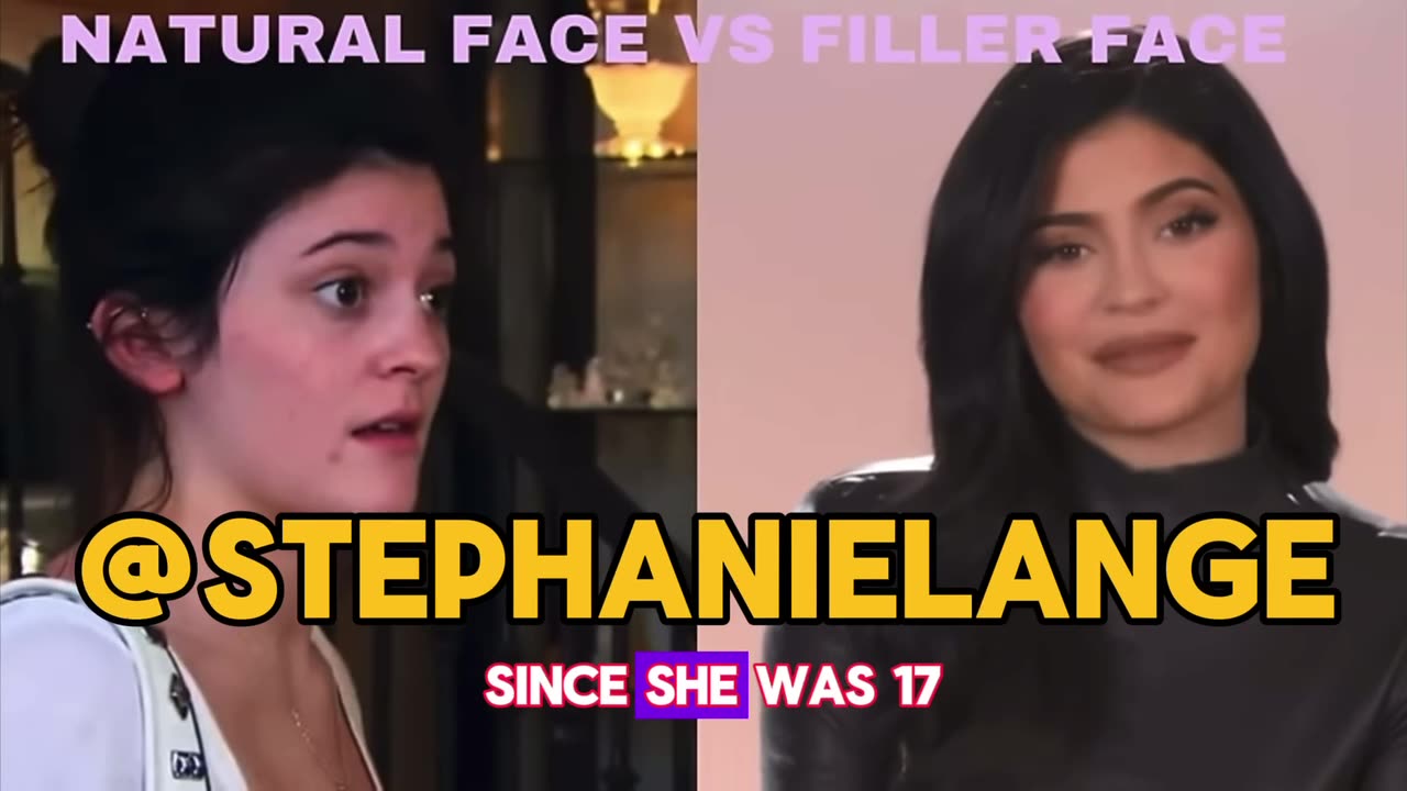 Kylie’s Filler w/ Stephanie Lange