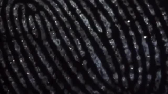 Sweaty fingers