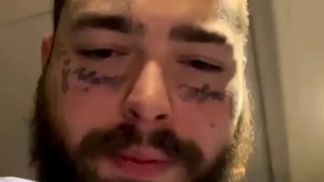 Post Malone explains how he broke his ribs in St. Louis