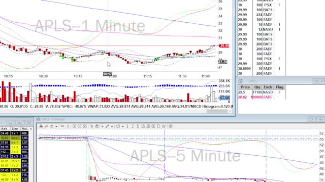 Day Trade Recap - 9.10.21 $APLS