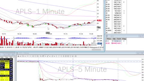 Day Trade Recap - 9.10.21 $APLS