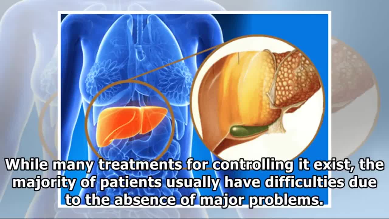 How to fight fatty liver Naturally with 5 Herbal Remedies