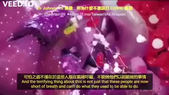 mRNA疫苗進入身體以後的影響-加拿大醫生追蹤疫苗接種