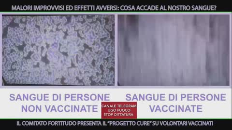 LE CURE DEL DOTTOR GIOVANNINI SUI VACCINATI FUNZIONANO: “LE ALTERAZIONI DEL SANGUE PRIMA RILEVATE SCOMPAIONO O MIGLIORANO SENSIBILMENTE!!”😇💖👍