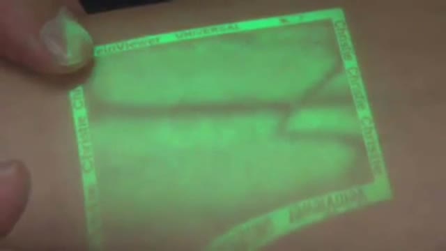 Smart X-Ray