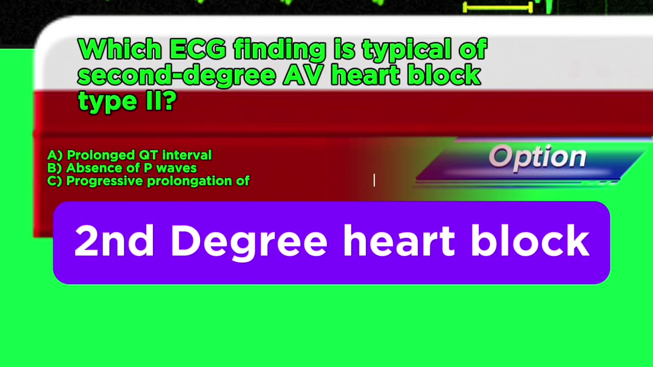 Second degree heart blockages #2nddegreeheartblock #arrthymias #CardiacArrhythmia