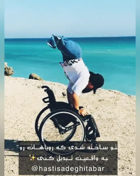 The beautiful woman dak amputee