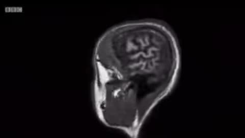 What Fuels Addiction, Junk Food & Neural Connections in your Brain *1min