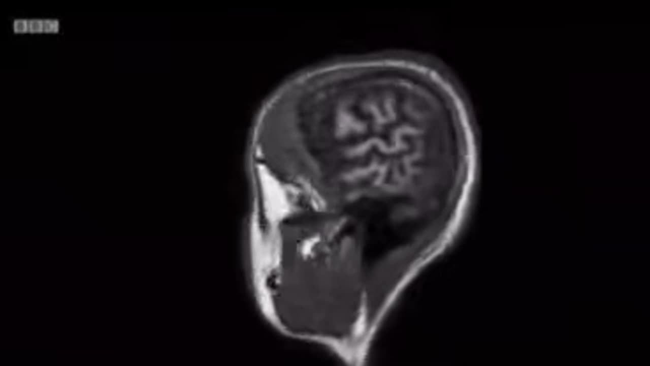What Fuels Addiction, Junk Food & Neural Connections in your Brain *1min