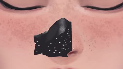 ASMR||Nose Blackheads Removal video