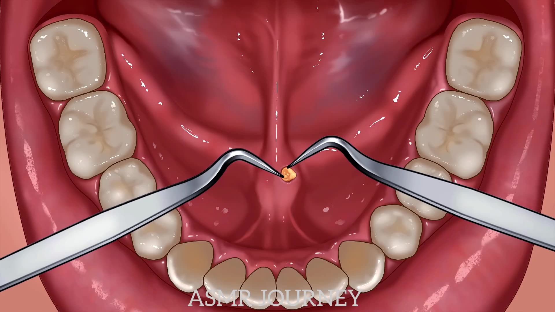 Sammy Asmr Rumble ASMR animation TREATMENT