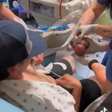 This baby was born at 22 weeks and still managed to survive: Life Begins @ Conception