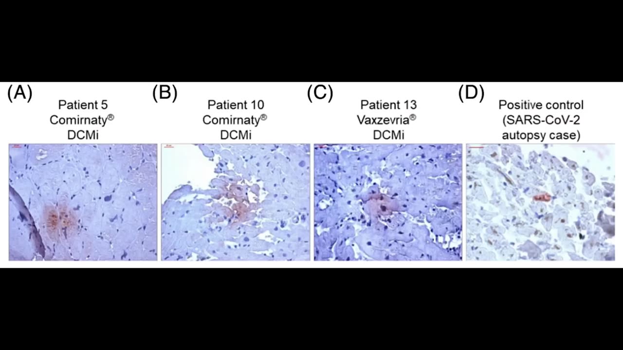 the spike protein was found in the heart