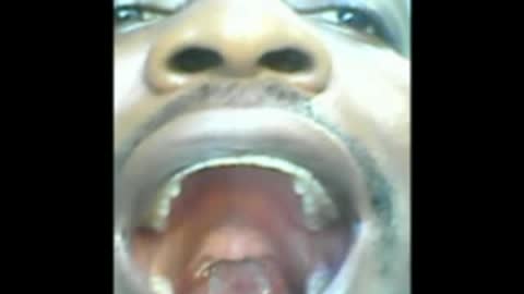 God have written his name on my tongue..LOOK ALL TUMOURS ON MY MOUTH