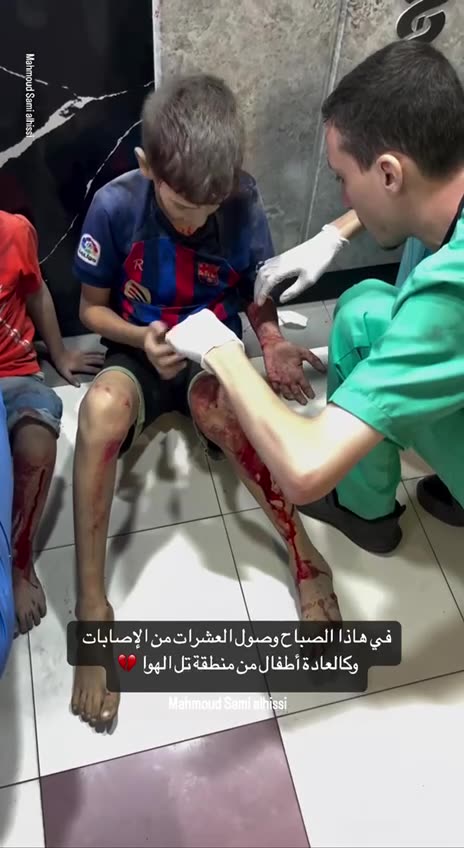 Children injured during Israeli bombing in Alhawa area in Gaza