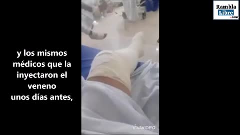 Vacunada por Pfizer y amputada