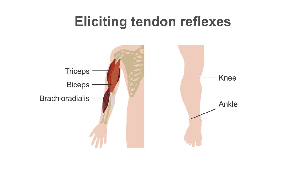 Clinical Neurology Essentials 6.Assessing reflexes