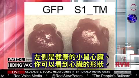 Expose 刺突蛋白的危害