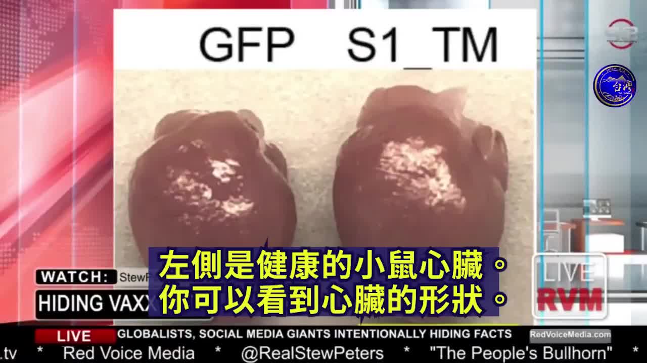 Expose 刺突蛋白的危害