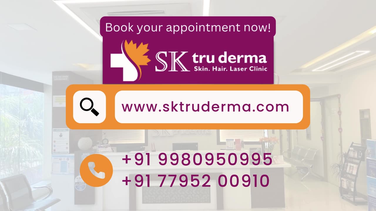 Wart Removal Treatment | Starting at ₹1450 @ SK Truderma | Skin Clinic in Sarjapur Road, Bangalore