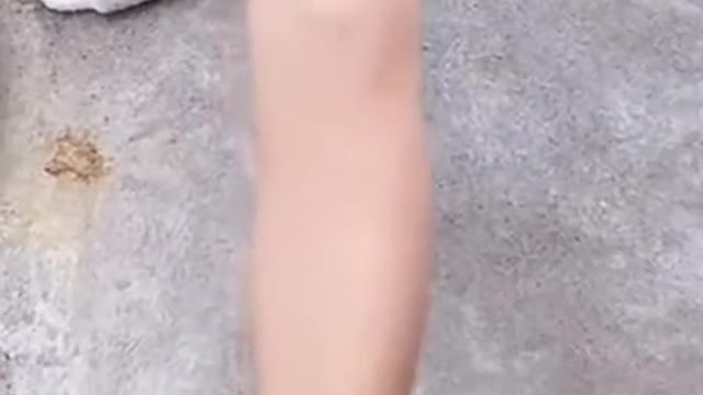 She has very elastic skin