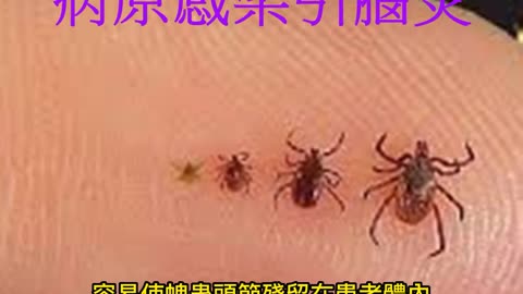 蜱蟲吸血 病原感染引腦炎