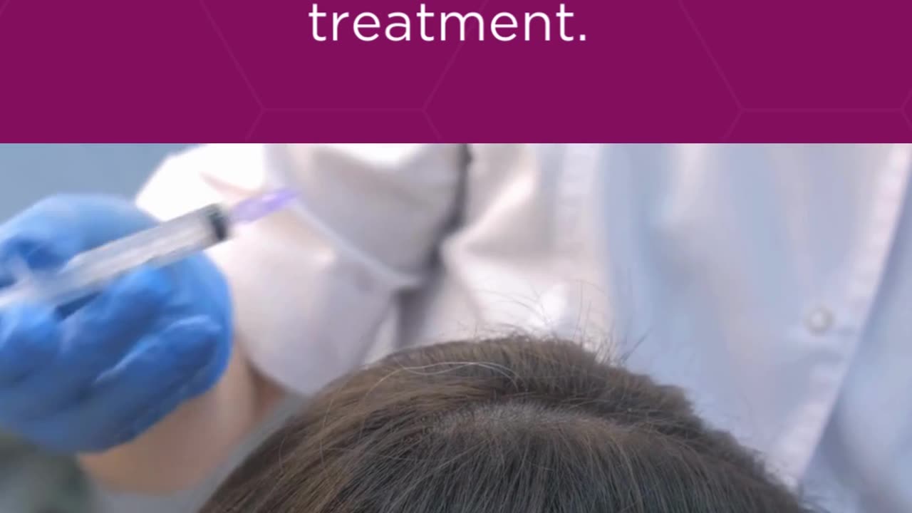 Who Can Benefit from Mesotherapy for Hair? Best Dermatologist in Sarjapur Road | SK Truderma