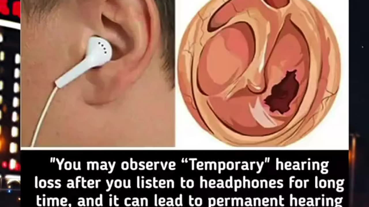 Revolutionary "Sonofit" Eardrum Bandage: A Breakthrough in Ear Health