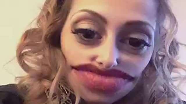 Big lips