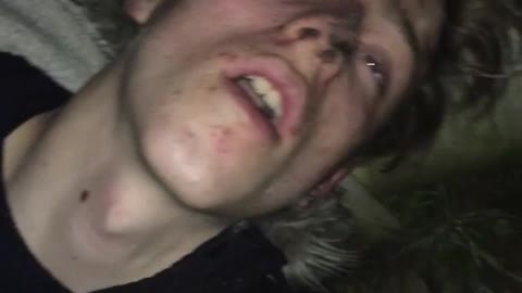 Guy black shirt asleep drunk on tree