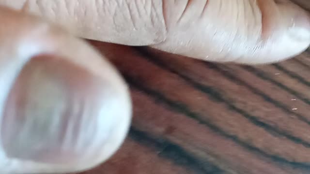 las uñas mas feas del mundo