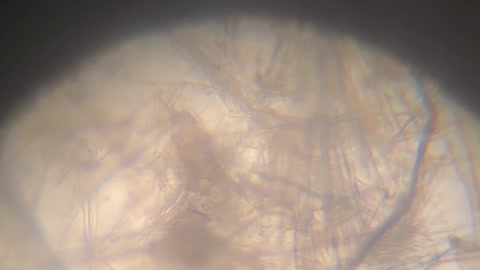 טכנולוגיה פעילה של גרפן אוקסיד ננו ליפידים בדגימת שתן בת 5 ימים זה מה שיש בתוך החיסונים.