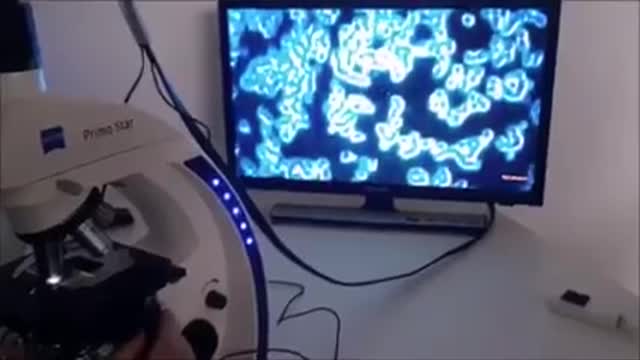 ANALISI DEL SANGUE DI PERSONE VACCINATE E NON