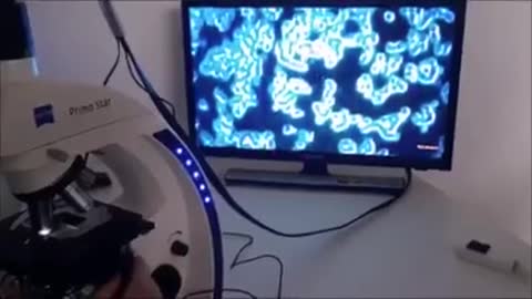 ANALISI DEL SANGUE DI PERSONE VACCINATE E NON