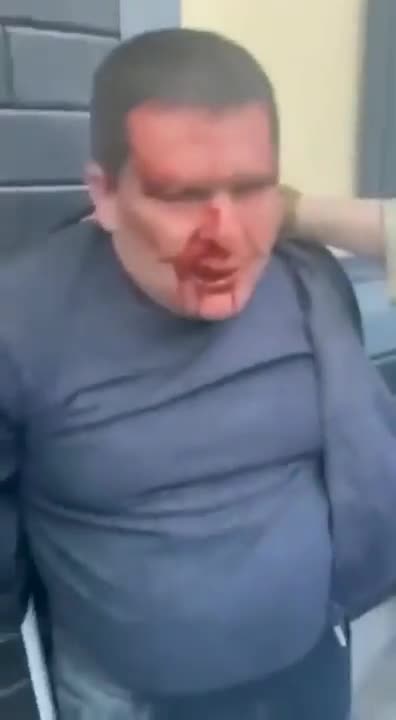 Ukranian WarCrimes against civilians 2022