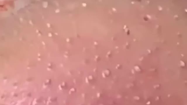 Relaxing video : clean pores #6